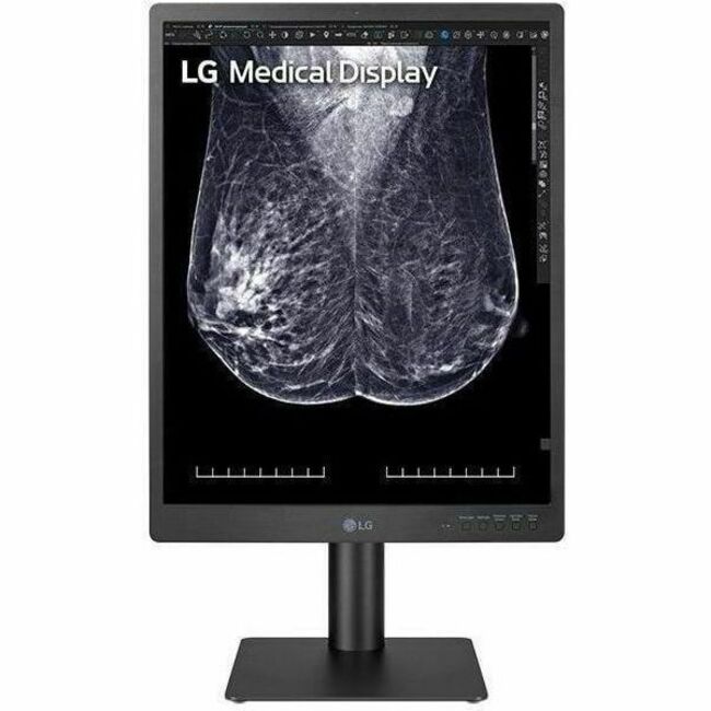 LG 21HQ613D-B 21" Class QSXGA LCD Monitor - 4:5 - Black — 21HQ613D-B