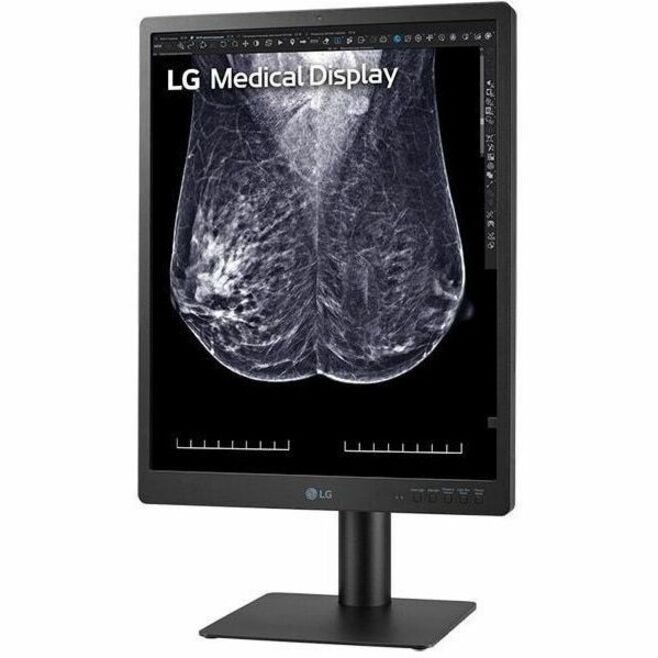 LG 21HQ613D-B 21" Class QSXGA LCD Monitor - 4:5 - Black — 21HQ613D-B
