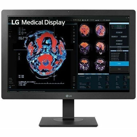 LG 24HR513C-B 24" Class WUXGA LCD Monitor - 16:10 — 24HR513C-B