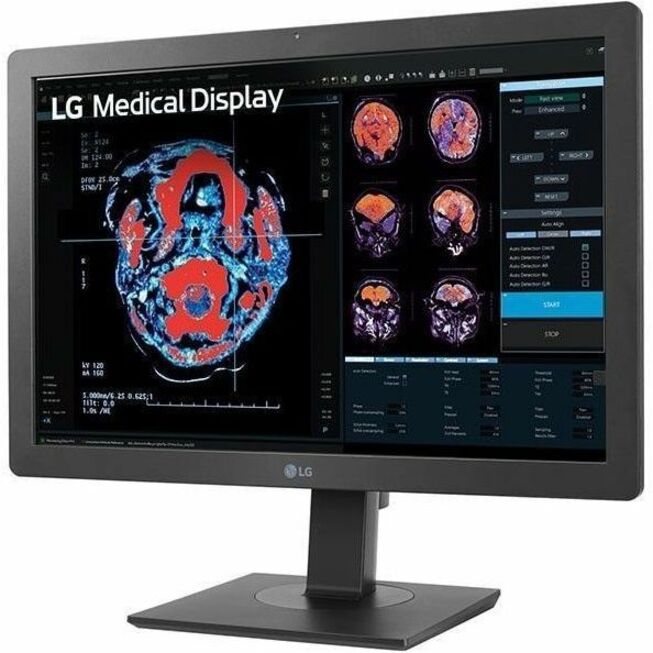 LG 24HR513C-B 24" Class WUXGA LCD Monitor - 16:10 — 24HR513C-B