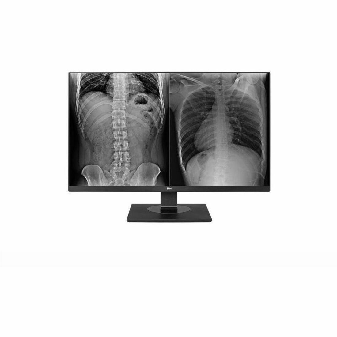 LG 27HJ713C-B 27" Class 4K LCD Monitor - 16:9 - Black — 27HJ713C-B
