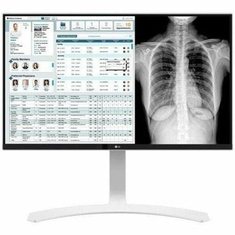LG 27HJ712C-W 27" Class 4K UHD LCD Monitor - 16:9 - White - TAA Compliant — 27HJ712C-W